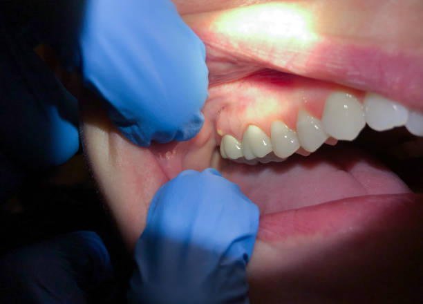 Best Broken or Chipped Tooth Repair in Dillingham, AK