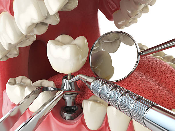 Best Emergency Treatment for Oral Infections in Dillingham, AK
