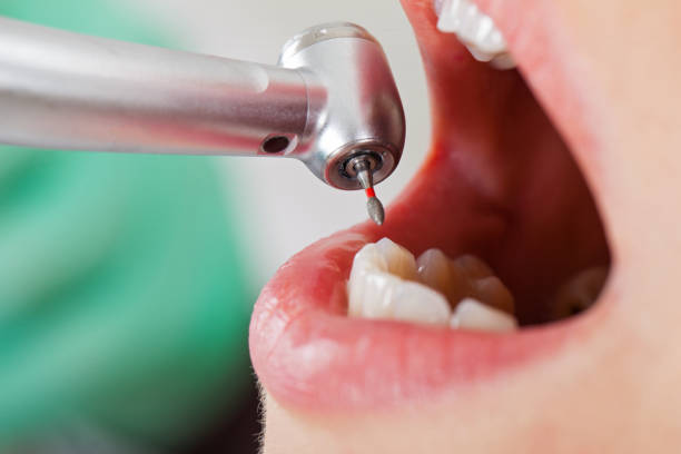 Best Dental Abscess Treatment in Dillingham, AK